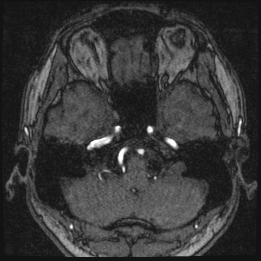 Click on the Serie image to view the images of VILLANUEVA, WILLIAM A.